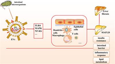 The Potential Role of Gut Microbial-Derived Exosomes in Metabolic-Associated Fatty Liver Disease: Implications for Treatment